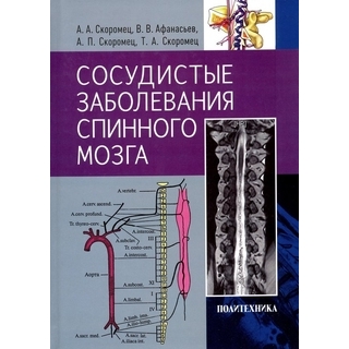 Сосудистые заболевания спинного мозга Скоромец А.А. 2019 г. (Политехника) Сосудистые заболевания спинного мозга Скоромец А.А. 2019 г. (Политехника)