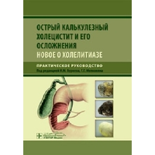 Острый калькулезный холецистит и его осложнения. Новое о холелитиазе Буриев 2020 г.(Гэотар) Острый калькулезный холецистит и его осложнения. Новое о холелитиазе Буриев 2020 г.(Гэотар)