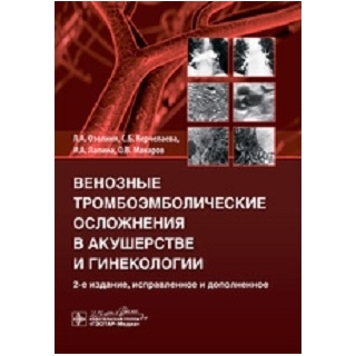 Венозные тромбоэмболические осложнения в акушерстве и гинекологии. 2-е изд. Озолиня 2020 г.(Гэотар) Венозные тромбоэмболические осложнения в акушерстве и гинекологии. 2-е изд. Озолиня 2020 г.(Гэотар)