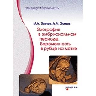 Эхография в эмбриональном периоде. Беременность в рубце на матке. М.А. Эсетов, А.М. Эсетов