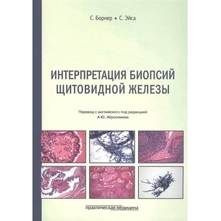 Интерпретация биопсий щитовидной железы 2020 г. (Практическая медицина) Интерпретация биопсий щитовидной железы 2020 г. (Практическая медицина)