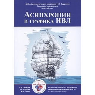 Асинхронии и графика ИВЛ. Полупан 2025 г. (Москва) Асинхронии и графика ИВЛ. Полупан 2025 г. (Москва)