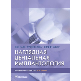 Наглядная дентальная имплантология Жак Мале, Фрэнсис Мора, Филипп Бушар 2021 г. (Гэотар) Наглядная дентальная имплантология Жак Мале, Фрэнсис Мора, Филипп Бушар 2021 г. (Гэотар)