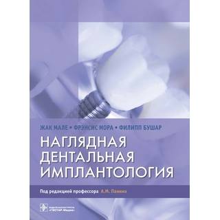 Наглядная дентальная имплантология Жак Мале, Фрэнсис Мора, Филипп Бушар 2021 г. (Гэотар)