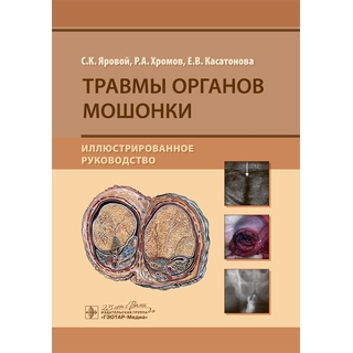 Травмы органов мошонки. Иллюстрированное руководство С. К. Яровой, Р. А. Хромов, Е. В. Касатонова 2020 (Гэотар) Травмы органов мошонки. Иллюстрированное руководство С. К. Яровой, Р. А. Хромов, Е. В. Касатонова 2020 (Гэотар)