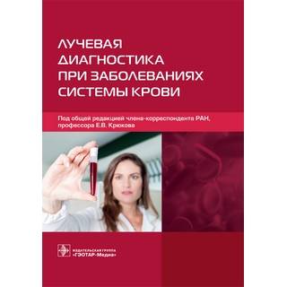 Лучевая диагностика при заболеваниях системы крови под общ. ред. Е. В. Крюкова 2021 (Гэотар)