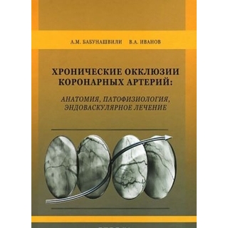 Хронические окклюзии коронарных артерий: анатомия, патофизиология, эндоваскулярное лечение Бабунашвили 2021 г. (Бином) Хронические окклюзии коронарных артерий: анатомия, патофизиология, эндоваскулярное лечение Бабунашвили 2021 г. (Бином)