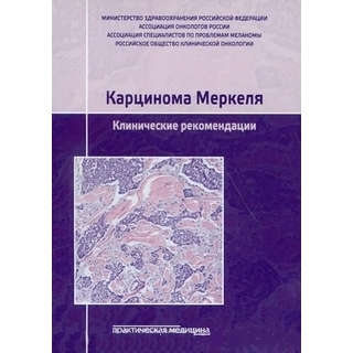 Карцинома Меркеля. Клинические рекомендации 2020 г (РОНЦ)