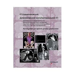 Динамическая мультиспиральная КТ. Кармазановский Г. Г. 2020 г. (Видар) Динамическая мультиспиральная КТ. Кармазановский Г. Г. 2020 г. (Видар)