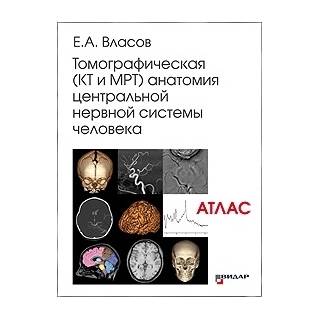 Томографическая (КТ и МРТ) анатомия центральной нервной системы человека. Атлас. Е.А.Власов 2020 г. (Видар)
