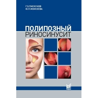 Полипозный риносинусит. Пискунов 2021 г. (МЕДпресс) Полипозный риносинусит. Пискунов 2021 г. (МЕДпресс)