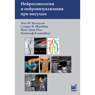 Нейросонология и нейровизуализация при инсульте. Вальдуэза Х.М., Шрайбер С.Й., 3 изд. 2024 г. (МЕДпресс) Нейросонология и нейровизуализация при инсульте. Вальдуэза Х.М., Шрайбер С.Й., 3 изд. 2024 г. (МЕДпресс)