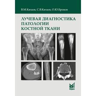 Лучевая диагностика патологии костной ткани. Китаев В.М. 2024 г. (МЕДпресс)