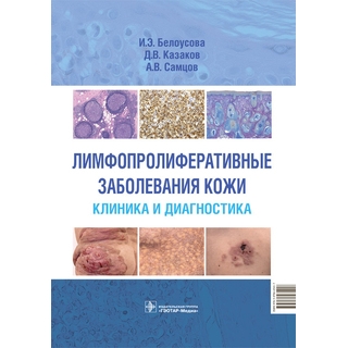 Лимфопролиферативные заболевания кожи. Клиника и диагностика. И. Э. Белоусова, Д. В. Казаков, А. В. Самцов 2022 г. (Гэотар) Лимфопролиферативные заболевания кожи. Клиника и диагностика. И. Э. Белоусова, Д. В. Казаков, А. В. Самцов 2022 г. (Гэотар)