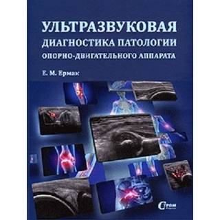Ультразвуковая диагностика патологии опорно-двигательного аппарата Ермак Е.М. 2015 г. (СтромФирма)