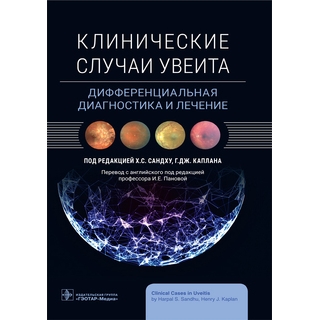 Клинические случаи увеита. Дифференциальная диагностика и лечение. под ред. Х. С. Сандху, Г. Дж. Каплана 2023 г (Гэотар) Клинические случаи увеита. Дифференциальная диагностика и лечение. под ред. Х. С. Сандху, Г. Дж. Каплана 2023 г (Гэотар)