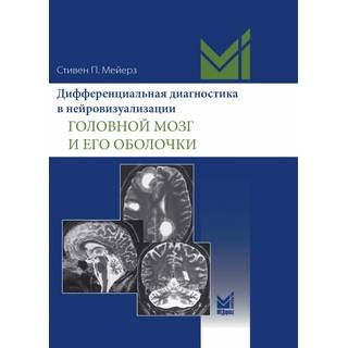 Дифференциальная диагностика в нейровизуализации. Головной мозг и его оболочки. Мейерз С.П. 2023 г. (МЕДпресс) Дифференциальная диагностика в нейровизуализации. Головной мозг и его оболочки. Мейерз С.П. 2023 г. (МЕДпресс)