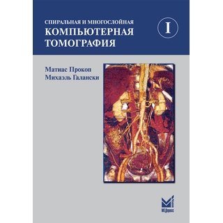 Спиральная и многослойная компьютерная томография. 1 том Прокоп М. Галански М. 2021 г. (МЕДпресс) Спиральная и многослойная компьютерная томография. 1 том Прокоп М. Галански М. 2021 г. (МЕДпресс)