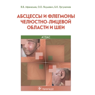 Абсцессы и флегмоны челюстно-лицевой области и шеи. Атлас. В.В. Афанасьев, О.О. Янушевич, Б.К. Ургуналиев. 2022 г. (Гэотар) Абсцессы и флегмоны челюстно-лицевой области и шеи. Атлас. В.В. Афанасьев, О.О. Янушевич, Б.К. Ургуналиев. 2022 г. (Гэотар)