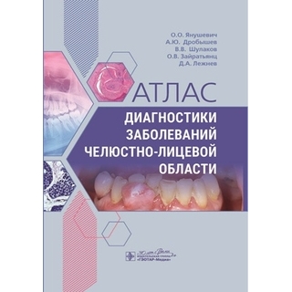 Атлас диагностики заболеваний челюстно-лицевой области. Янушевич О.О., Дробышев А.Ю., Шулаков В.В 2024 г. (Гэотар) Атлас диагностики заболеваний челюстно-лицевой области. Янушевич О.О., Дробышев А.Ю., Шулаков В.В 2024 г. (Гэотар)