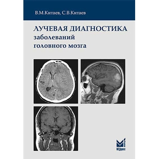 Лучевая диагностика заболеваний головного мозга Китаев В.М. С.В.Китаев 2024 г. (МЕДпресс) Лучевая диагностика заболеваний головного мозга Китаев В.М. С.В.Китаев 2024 г. (МЕДпресс)