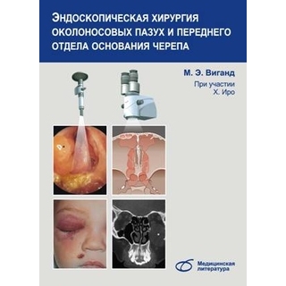 Эндоскопическая хирургия околоносовых пазух и переднего отдела основания черепа (монография) М. Э. Виганд 2014 г. (Медицинская литература) Эндоскопическая хирургия околоносовых пазух и переднего отдела основания черепа (монография) М. Э. Виганд 2014 г. (Медицинская литература)