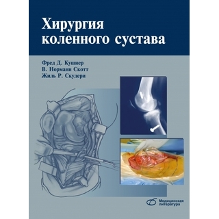 Хирургия коленного сустава Ф.Д. Кушнер 2014 г. (Медицинская литература) Хирургия коленного сустава Ф.Д. Кушнер 2014 г. (Медицинская литература)