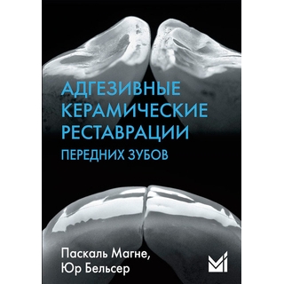 Адгезивные керамические реставрации передних зубов Манье П. 2024 г. (МЕДпресс) Адгезивные керамические реставрации передних зубов Манье П. 2024 г. (МЕДпресс)