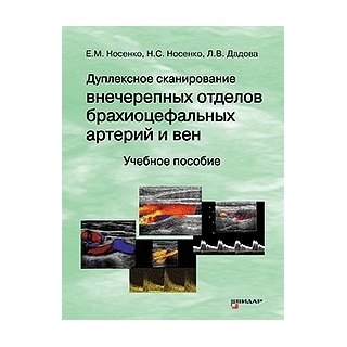 Дуплексное сканирование внечерепных отделов брахиоцефальных артерий и вен. Методика исследования. Носенко Е.М., Дадова Л.В. 2022 г. (Видар) Дуплексное сканирование внечерепных отделов брахиоцефальных артерий и вен. Методика исследования. Носенко Е.М., Дадова Л.В. 2022 г. (Видар)