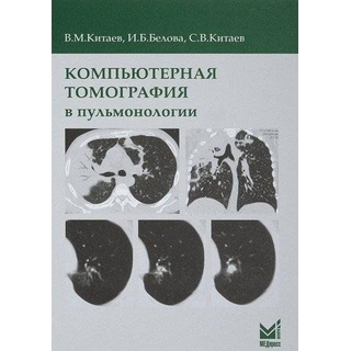 Компьютерная томография в пульмонологии Китаев В.М. 2024 г. (МЕДпресс)