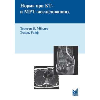 Норма при КТ и МРТ исследованиях Мёллер Т.Б. Райф Э. 2026 г. (МЕДпресс) Норма при КТ и МРТ исследованиях Мёллер Т.Б. Райф Э. 2026 г. (МЕДпресс)
