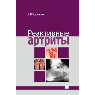 Реактивные артриты. Урогенитальные и постэнтероколитические. Бадокин В.В 2022 г. (МЕДпресс)