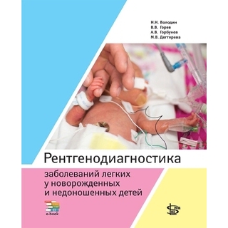 Рентгенодиагностика заболеваний легких у новорожденных и недоношенных детей. Володин Н.Н., Горев В.В., Горбунов А.В. 2024 г. (Логосфера) Рентгенодиагностика заболеваний легких у новорожденных и недоношенных детей. Володин Н.Н., Горев В.В., Горбунов А.В. 2024 г. (Логосфера)