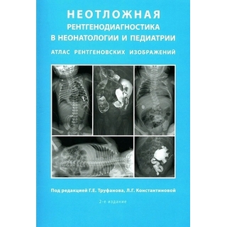 Неотложная рентгенодиагностика в неонатологии и педиатрии (Атлас рентгеновских изображений). Труфанов Г.Е. 2024 г. (ЭЛБИ) Неотложная рентгенодиагностика в неонатологии и педиатрии (Атлас рентгеновских изображений). Труфанов Г.Е. 2024 г. (ЭЛБИ)