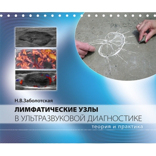 Лимфатические узлы в ультразвуковой диагностике. Заболотская Н.В. 2025 г. (МедПресс) Лимфатические узлы в ультразвуковой диагностике. Заболотская Н.В. 2025 г. (МедПресс)