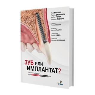  Зуб или имплантат? Пио Бертани, Паоло Дженерали 2025 г. (Дентал-Азбука)