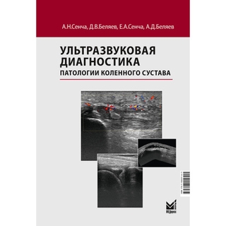 Ультразвуковая диагностика патологии коленного сустава Сенча А.Н., Беляев Д.В., Сенча Е.А., Беляев А.Д. 2026 г. (МЕДпресс) Ультразвуковая диагностика патологии коленного сустава Сенча А.Н., Беляев Д.В., Сенча Е.А., Беляев А.Д. 2026 г. (МЕДпресс)