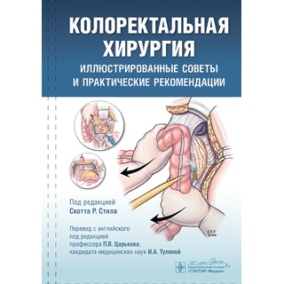 Колоректальная хирургия. Иллюстрированные советы и практические рекомендации / под ред. Скотта Р. Стила 2025 г. (Гэотар) Колоректальная хирургия. Иллюстрированные советы и практические рекомендации / под ред. Скотта Р. Стила 2025 г. (Гэотар)